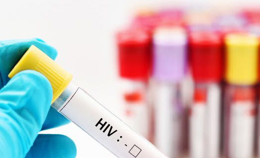 Những lưu ý khi chăm trẻ sinh ra từ mẹ nhiễm HIV