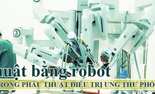 Phẫu thuật bằng robot - tiến bộ mới trong phẫu thuật điều trị ung thư phổi